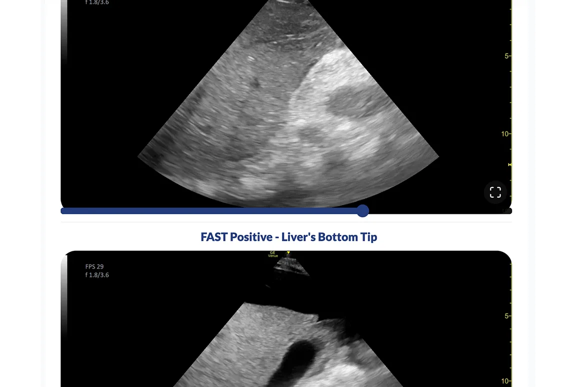 Ultrasound Module